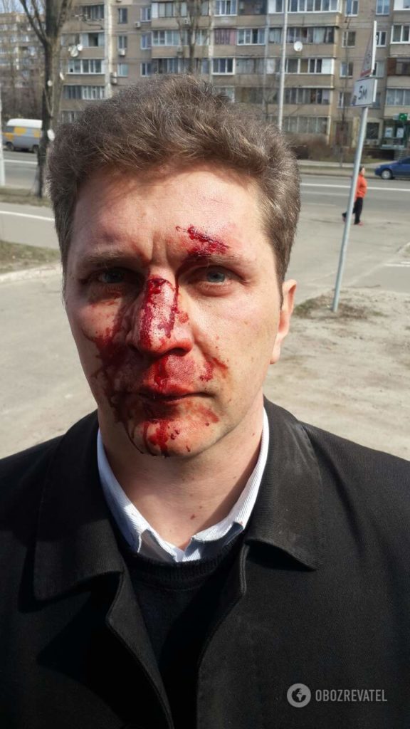 В Киеве был зверски избит врач, который рассказал всю правду о коррупции в медицине