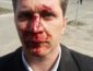 В Киеве был зверски избит врач, который рассказал всю правду о коррупции в медицине