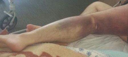 «Ноги синие от побоев...» Полицейские жестоко избили украинца за майнинг криптовалюты. ФОТО