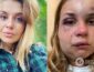 В поезде Мариуполь-Киев избили и пытались изнасиловать женщину (ВИДЕО 18+)